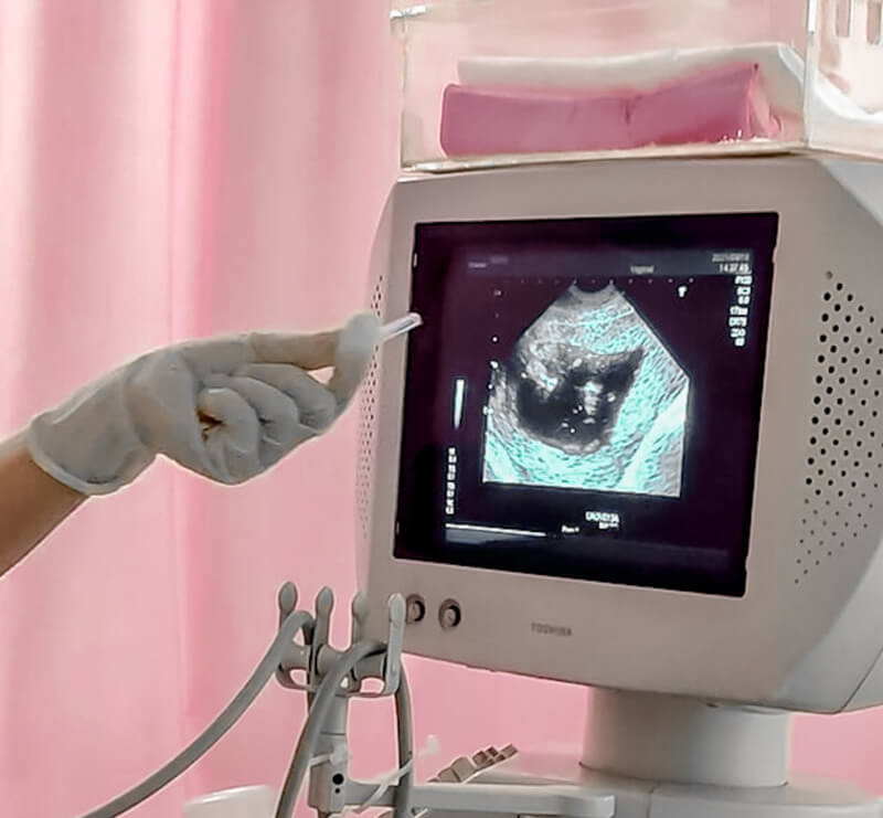 懷孕週數滿16週，在柯滄銘婦產科做羊膜穿刺，超音波顯示寶寶在亂揮手